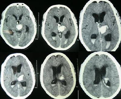 Example axial head CT